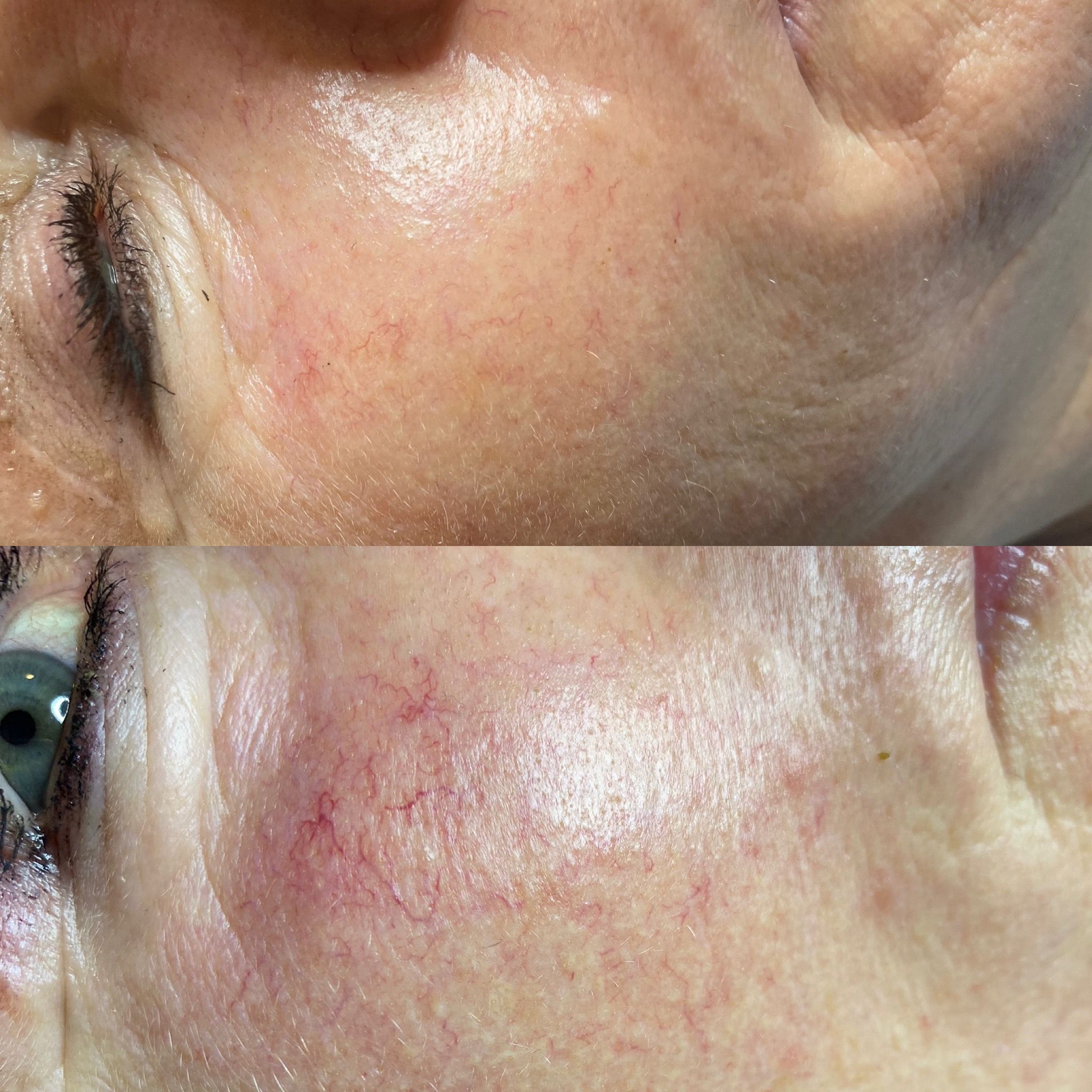 Wimper & wenkbrauw specialist